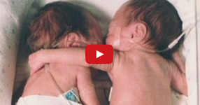 Новородено бебе умираше, но решиха да сложат нейната сестричка близначка до нея. След това, се случи чудо! (ВИДЕО)
