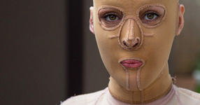 Една завистлива жена я обезобразява подпалвайки я... 2 години по-късно, маха маската и показва новото си лице (СНИМКИ)